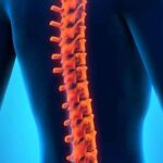 Реконструкция позвоночника: новый метод лечения