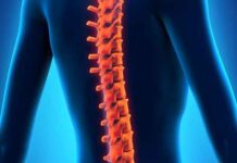 Реконструкция позвоночника: новый метод лечения