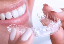 Красивая улыбка с элайнерами: Революционный подход к ортодонтическому лечению