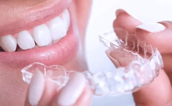 Красивая улыбка с элайнерами: Революционный подход к ортодонтическому лечению