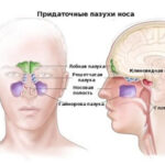 МРТ околоносовых пазух носа — диагностика и ее значение