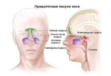 МРТ околоносовых пазух носа — диагностика и ее значение