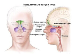 МРТ околоносовых пазух носа — диагностика и ее значение