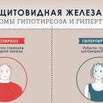 Гомеопатия в лечении гипотиреоза: альтернативный подход к восстановлению щитовидной железы