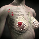 Гормональная терапия рака молочной железы