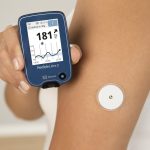 Датчик мониторинга глюкозы: Инновации в заботе о здоровье диабетиков