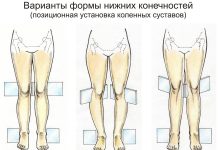 Преимущества операций по коррекции кривизны ног и увеличению роста человека