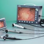 Подготовка к цистоскопии: Важные шаги перед процедурой