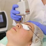Лазерная шлифовка лица: ключ к идеальной коже