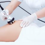 Методы аппаратной коррекции фигуры: современные технологии и их эффективность