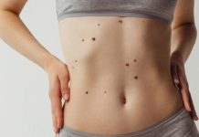 Дерматоскопия: современный метод диагностики кожных заболеваний