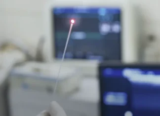 Transform Your Life with Endovenous Laser Coagulation for Varicose Veins in Dubai