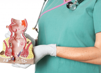 Когда стоит обратиться к врачу-проктологу: основные признаки и рекомендации