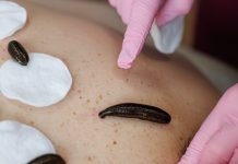 Цена лечения пиявками в Балашихе: насколько доступно эффективное восстановление без таблеток?