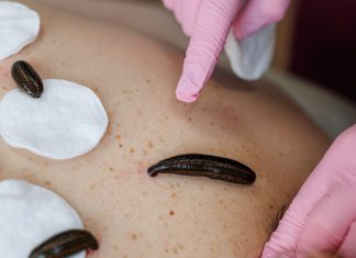 Цена лечения пиявками в Балашихе: насколько доступно эффективное восстановление без таблеток?