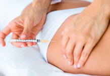 Побочные эффекты липолитиков: как их предотвратить и управлять ими?