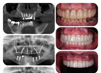Как выбрать стоматолога: от первых шагов до уверенного выбора