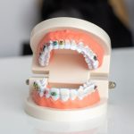 Улыбайтесь без комплексов — профессиональная помощь стоматолога рядом