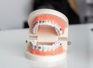 Улыбайтесь без комплексов — профессиональная помощь стоматолога рядом