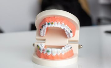 Улыбайтесь без комплексов — профессиональная помощь стоматолога рядом