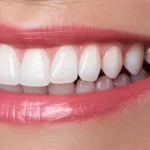 Секреты здоровой улыбки: Советы стоматологов для ухода за зубами