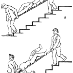 Спуск больного с лестницы: Ключевые аспекты безопасной транспортировки