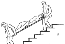 Спуск больного с лестницы: Ключевые аспекты безопасной транспортировки