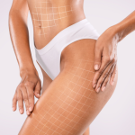 Что Такое RF-лифтинг и Как Он Работает?