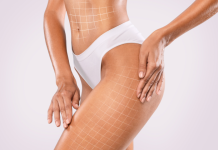 Что Такое RF-лифтинг и Как Он Работает?