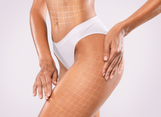 Что Такое RF-лифтинг и Как Он Работает?