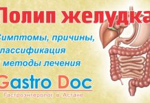 Когда обратиться к гастроэнтерологу: важные сигналы вашего организма