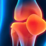 Болит спина? Не терпите боль – найдите решение! Современные методы лечения позвоночника