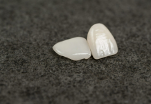 Коронка на зуб: что нужно знать перед установкой