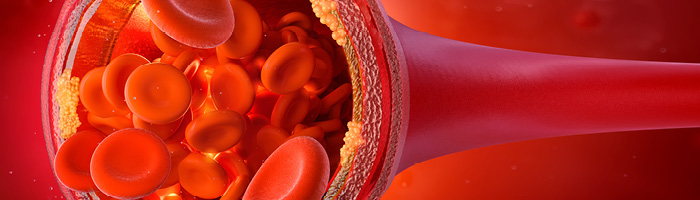 гиполипидемический препарат от msd успешно прошел очередное исследование