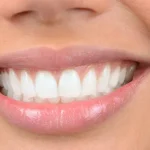 Металлокерамические коронки в современной стоматологии