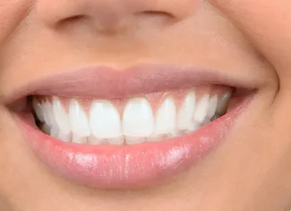 Металлокерамические коронки в современной стоматологии