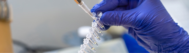 новый тест для быстрого выявления возбудителей шигиллеза разработан учеными роспотребнадзора