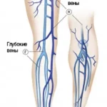 Что входит в косметическую флебологию?