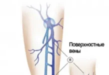 Что входит в косметическую флебологию?
