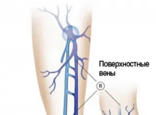 Что входит в косметическую флебологию?