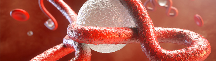 суданский штамм вируса эбола может сохраняться в организме несколько месяцев