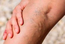 Диагностика венозных заболеваний: важные этапы и современные подходы