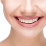 Преимущества имплантации зубов: восстановление уверенности и здоровья