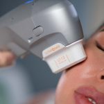 Векторный лифтинг: современная методика омоложения лица